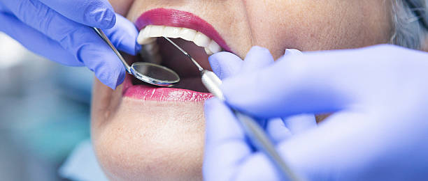 Best Dental Abscess Treatment in East Grand Rapids, MI